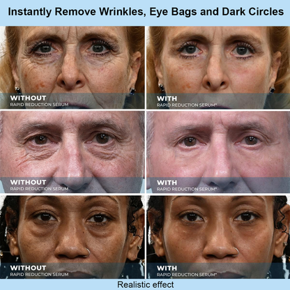 Vokpet™ Instant Face Temporary Tightener – Instant visible results in 30 seconds